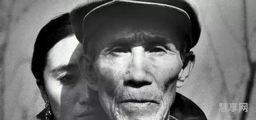 世界上什么人一下子变老?(面部年轻化的最好方法)