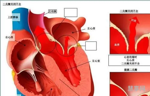 射入的意思是什么(洒入和射入的区别)